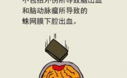 脑出血人保能报吗（脑出血保险理赔吗）